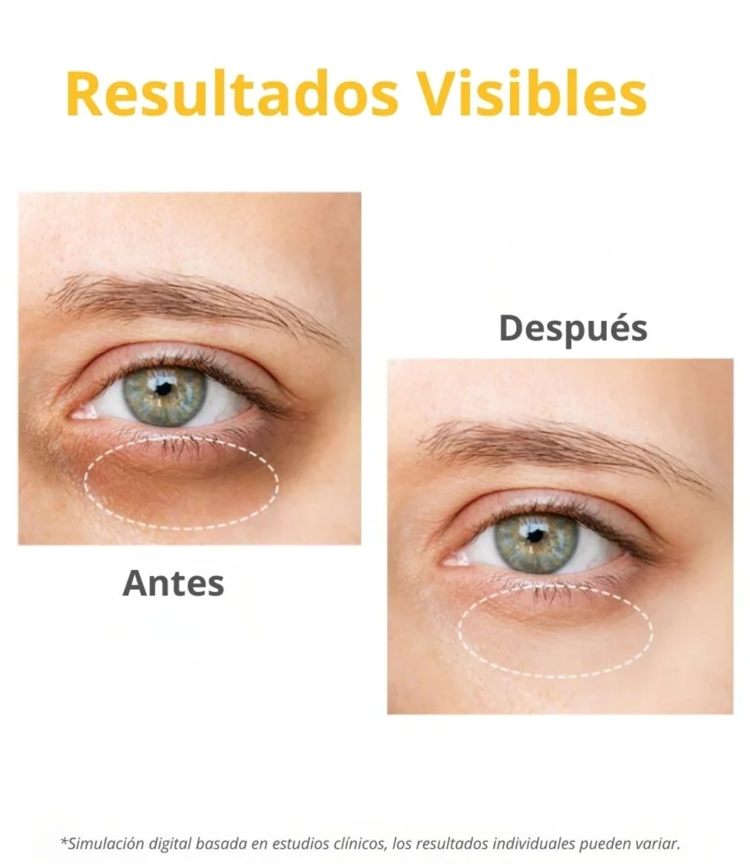 Contorno de Ojos - Dark Circle Eye Serum (#OOTD) - 25g