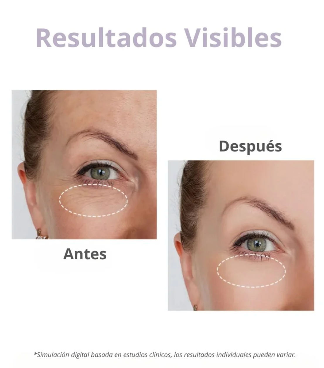 Contorno de Ojos - Overnight Eye Cream (#OOTD) - 25g